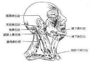 頜面部炎癥